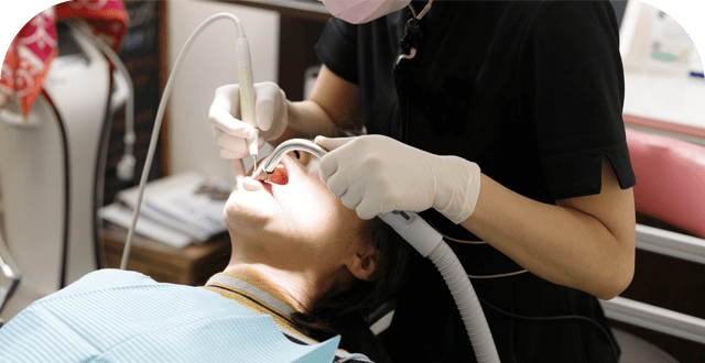 歯科予防処置イメージ